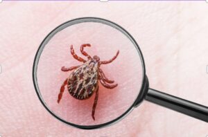 Close up of a tick under a small microscope. The tick, which carries Lyme Disease, is on the surface of a person's skin, presumably biting them.