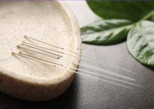 Six acupuncture needles lay in a small brown dish surrounded by healthy green leaves, a symbol of vitality.